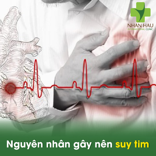 Nguyên nhân gây nên suy tim
