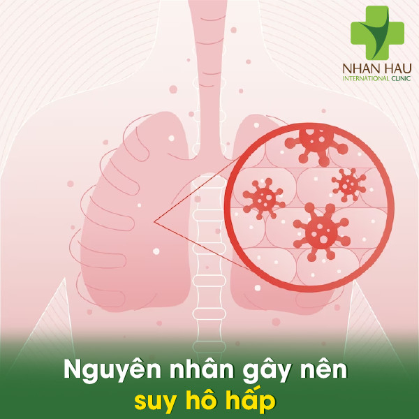 Nguyên nhân gây nên suy hô hấp