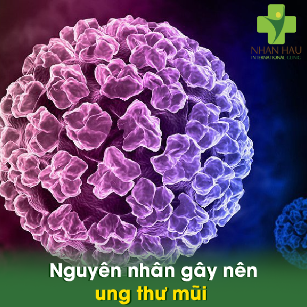 Nguyên nhân gây nên ung thư mũi