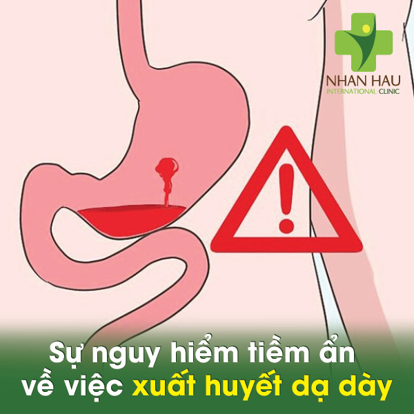 Sự nguy hiểm tiềm ẩn về việc xuất huyết dạ dày