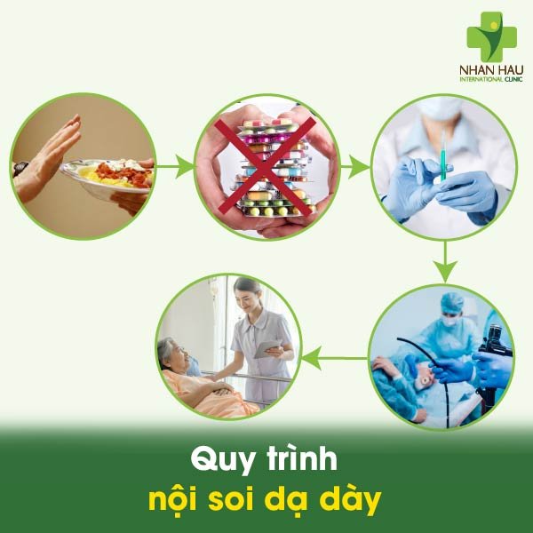 Quy trình nội soi dạ dày