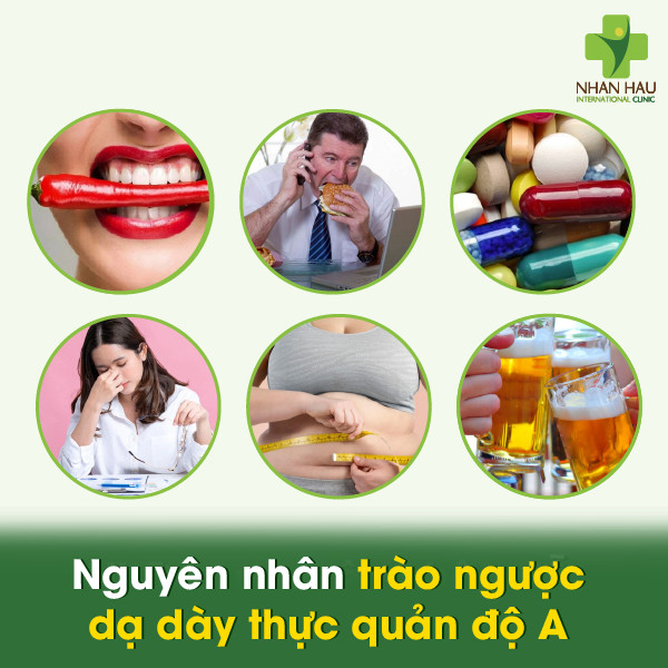 Nguyên nhân trào ngược dạ dày thực quản độ A
