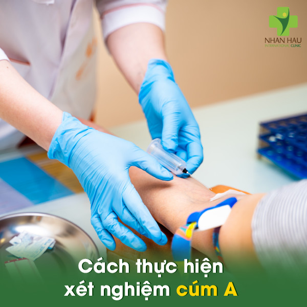 Cách thực hiện xét nghiệm cúm A