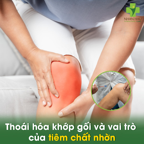 Thoái hóa khớp gối và vai trò của tiêm chất nhờn