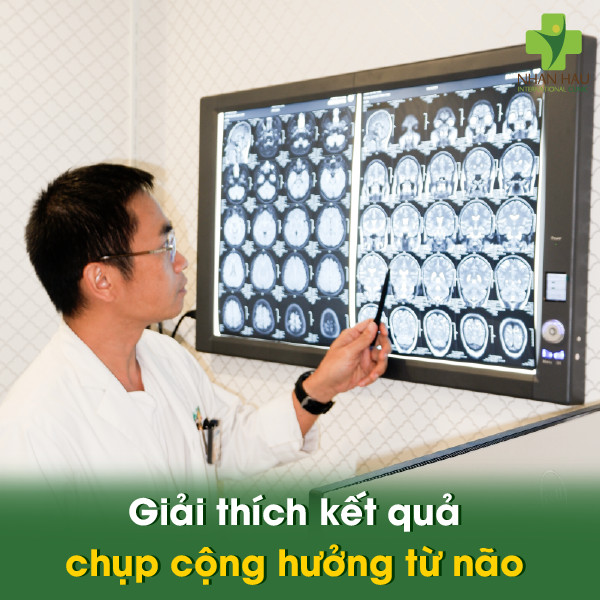 Giải thích kết quả chụp cộng hưởng từ não
