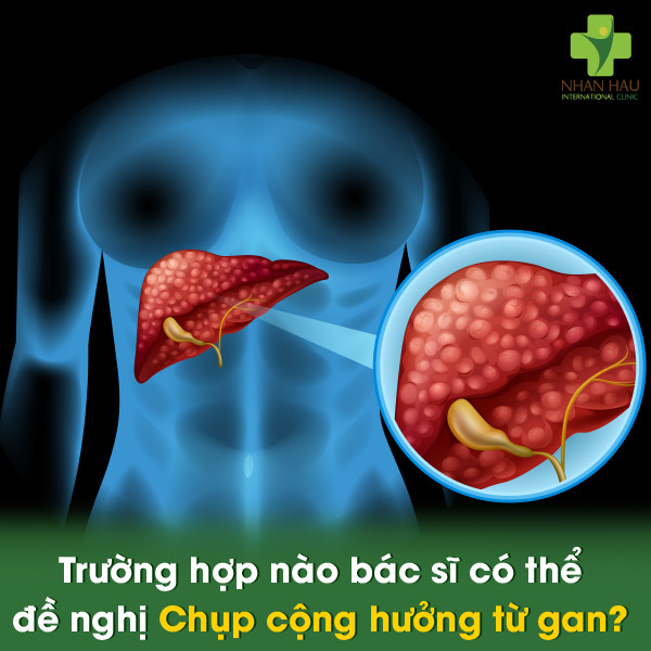Trường hợp nào bác sĩ có thể đề nghị Chụp cộng hưởng từ gan?