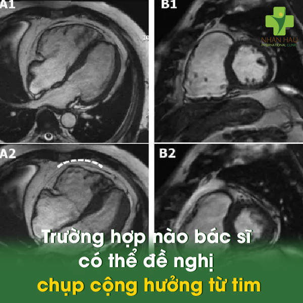 Trường hợp nào bác sĩ có thể đề nghị chụp cộng hưởng từ tim